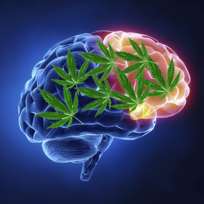 The Truth About Cannabis and Brain Cells What the Research Says
